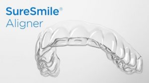 sure smile clear aligners